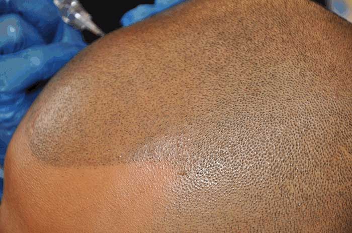 Татуировка, которая скроет мужскую лысину (9 фото)